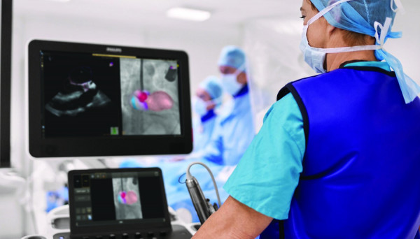 Philips anuncia nuevo equipo para cardiólogos